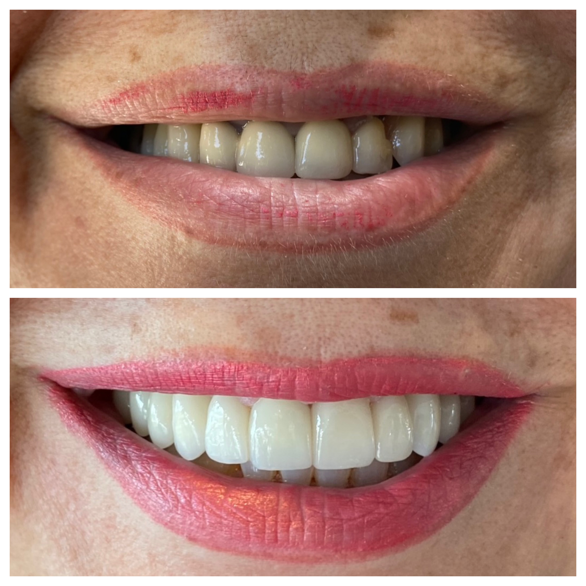 Patient outcome. Dr. Baradaran.